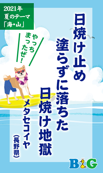 日焼け止め　塗らずに落ちた　日焼け地獄